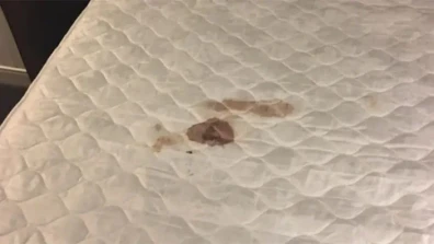 How to Get Blood out of Mattress