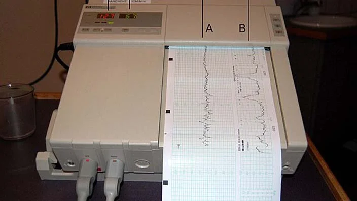 working of cardiotocography ctg