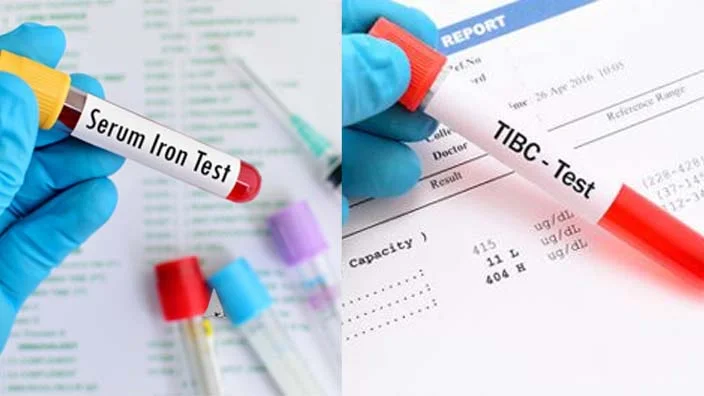 ferritin level tests images of tibc