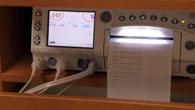 How to Read a Contraction Monitor