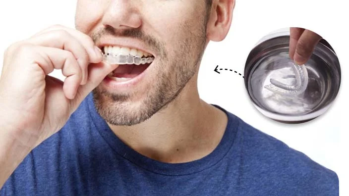 8 how to mold a mouthguard